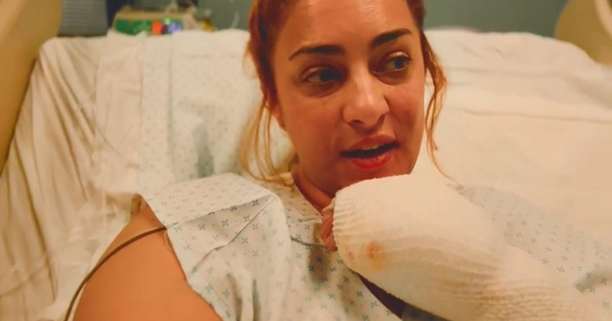 Cómo contó María Julia Oliván desde el hospital, el accidente en el que se quemó el 25 por ciento del cuerpo