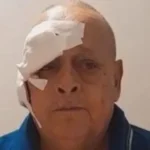 Veterano de Malvinas busca ayuda para enfrentar un cáncer de piel