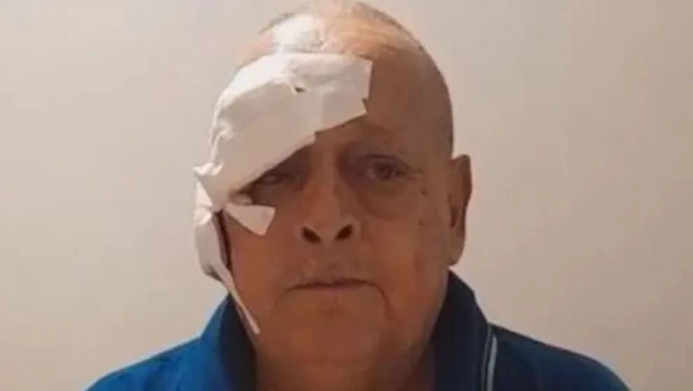 Veterano de Malvinas busca ayuda para enfrentar un cáncer de piel