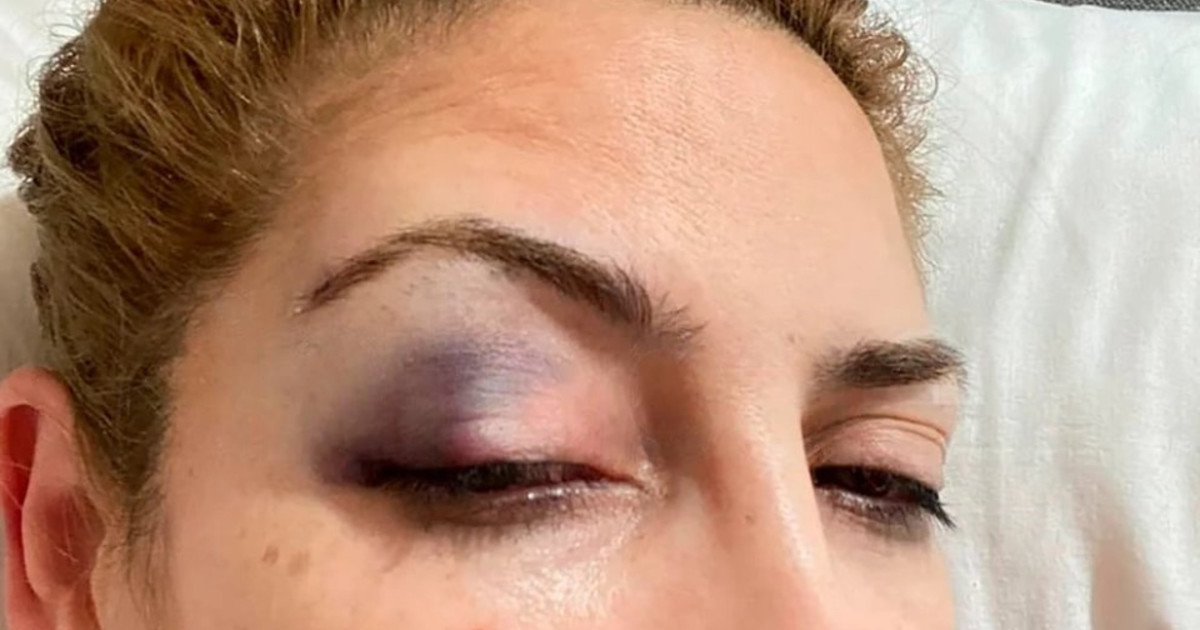 Fabiola Yañez dio detalles de uno de los hechos de violencia por los que denunció a Alberto Fernández