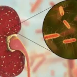 Comodoro se mantiene libre de casos de Síndrome Urémico Hemolítico y alerta sobre cuidados
